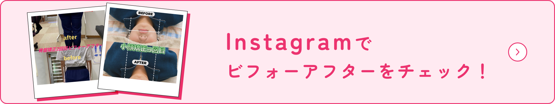 Instagramでビフォーアフターをチェック！